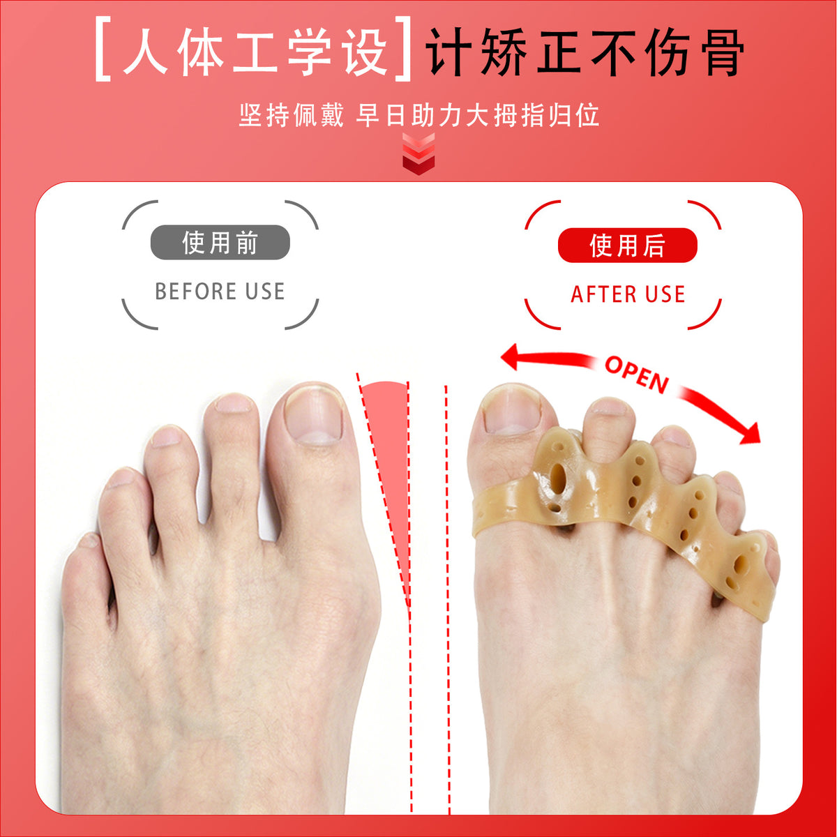 Five-toe separation silicone toe corrector for hallux valgus, big toe overlapping toe separator, yoga toe protector - image 4