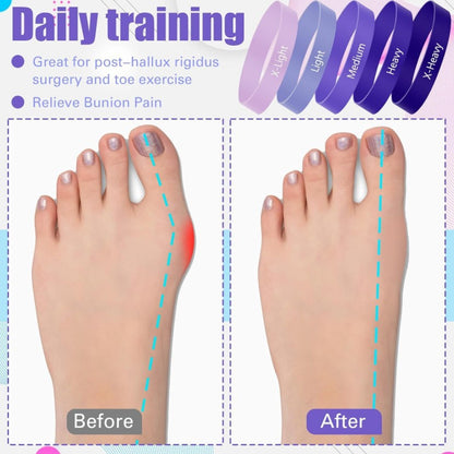 Toe and Finger Resistance Bands Thumb Fitness Training Stretching Device Mouse Hand Grip Circle Finger Ring Set - image 3